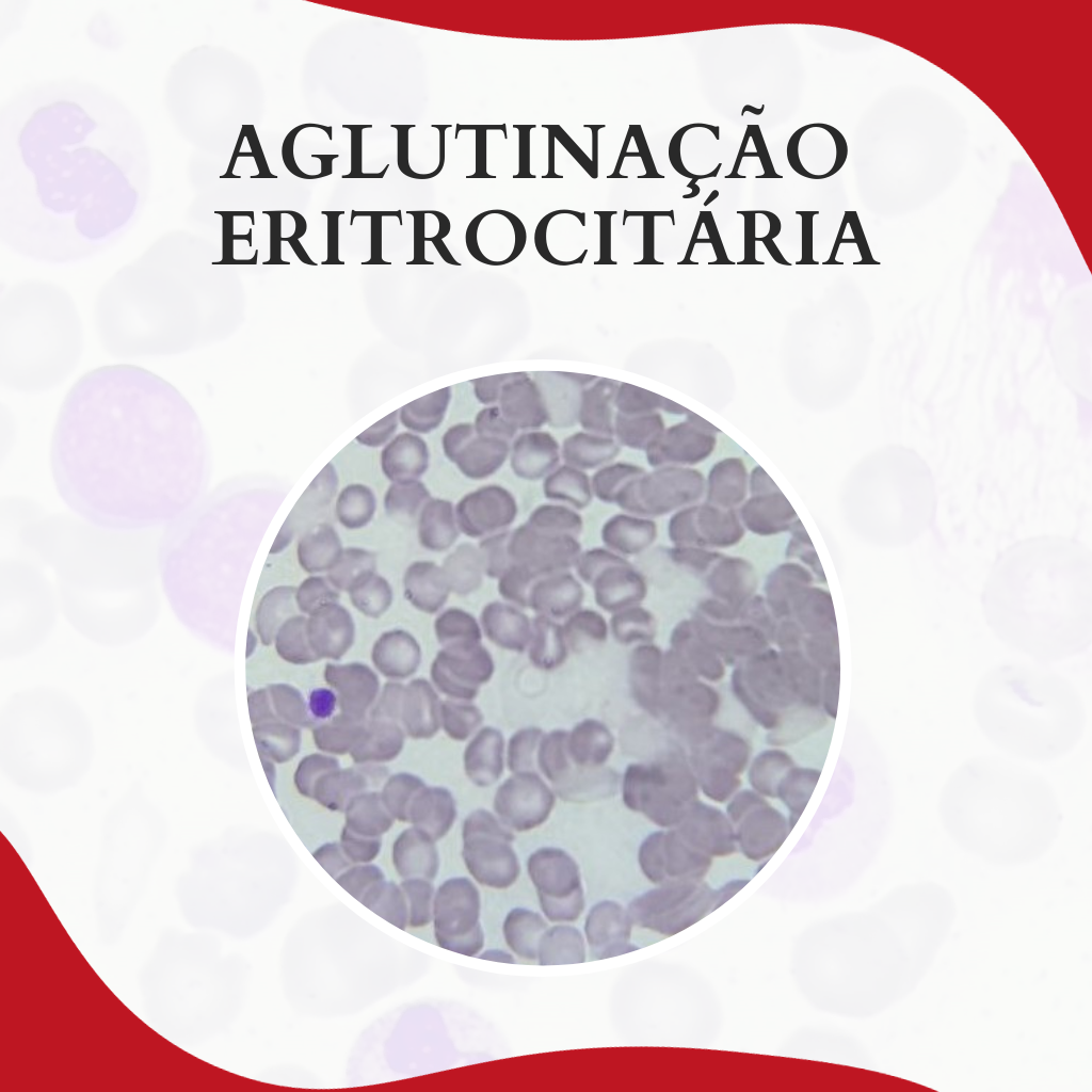 Aglutinação eritrocitária identificação e solução Atlas Em Hematologia