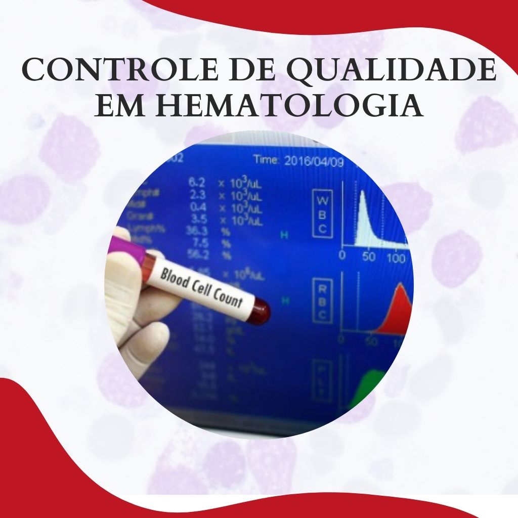 Controle De Qualidade Em Hematologia Atlas Em Hematologia