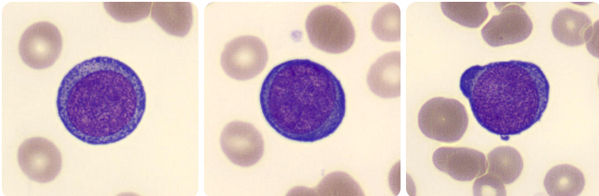 eritropoiese