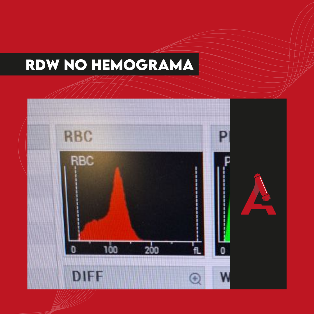 RDW no hemograma - Blog - Atlas em Hematologia