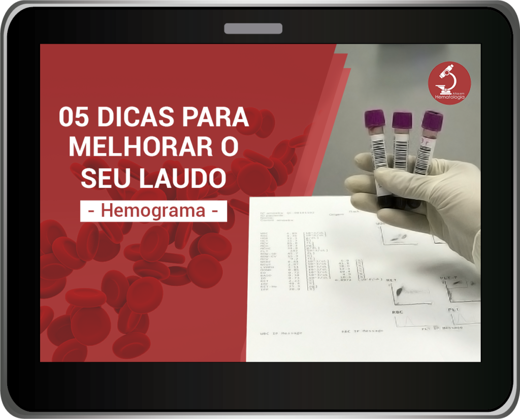 Ebook 5 Dicas Do Hemograma Atlas Em Hematologia 5966