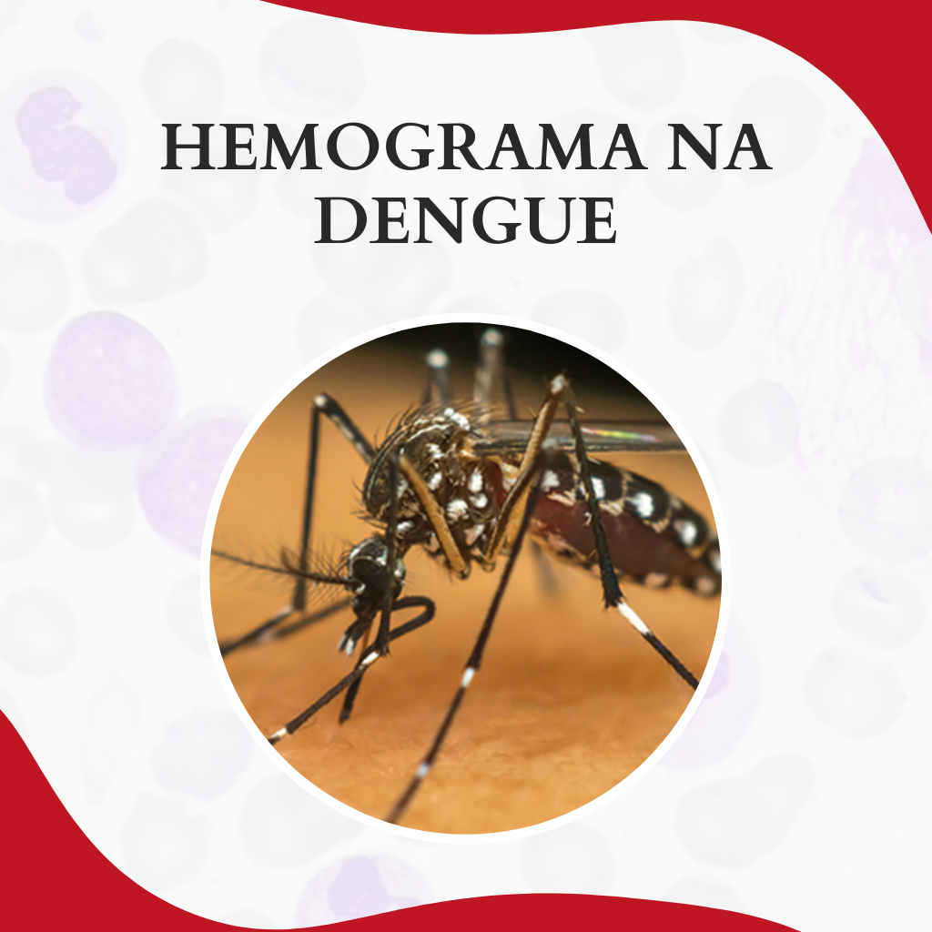 Hemograma Na Dengue Atlas Em Hematologia Time Atlas