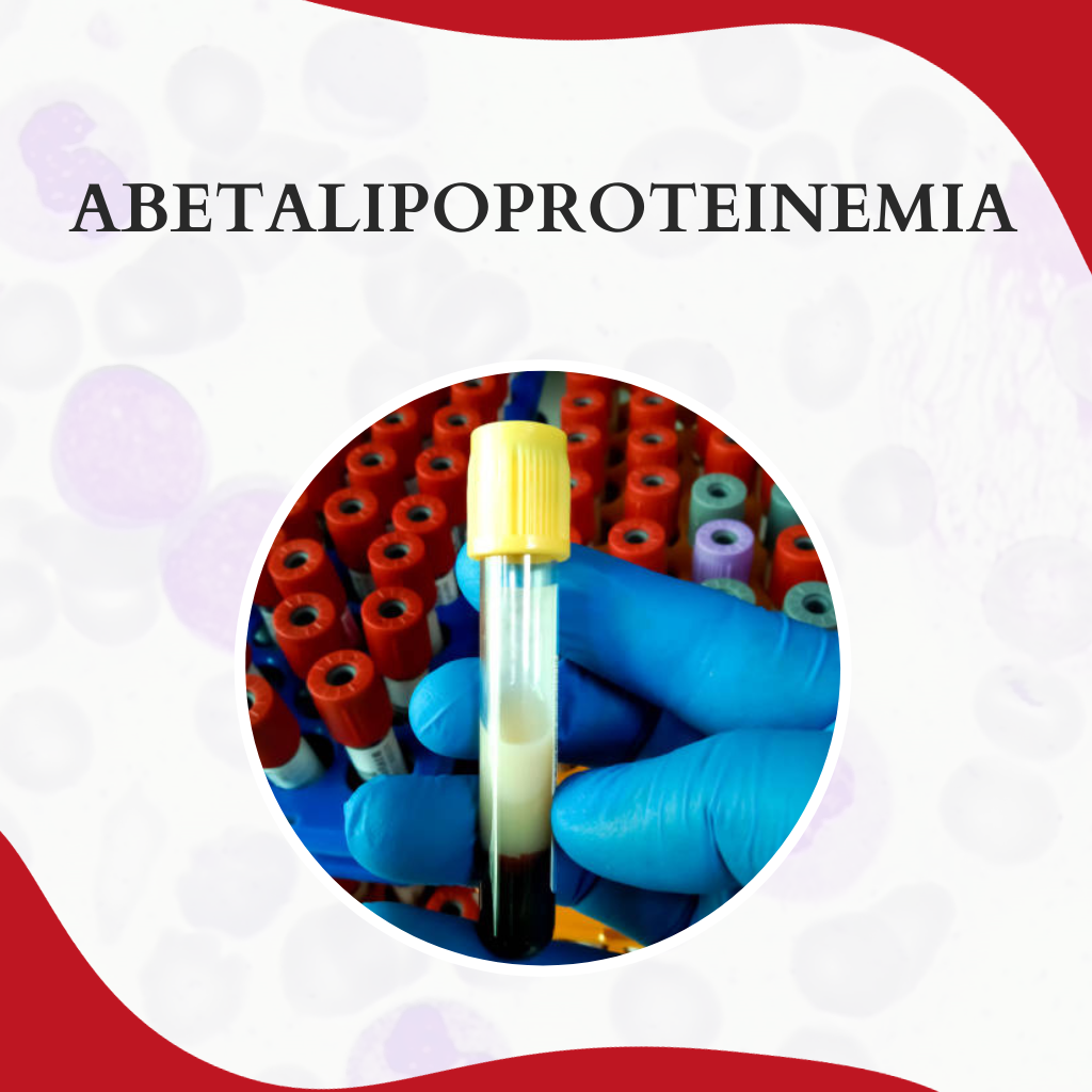 Abetalipoproteinemia: entenda o mecanismo - Atlas Em Hematologia