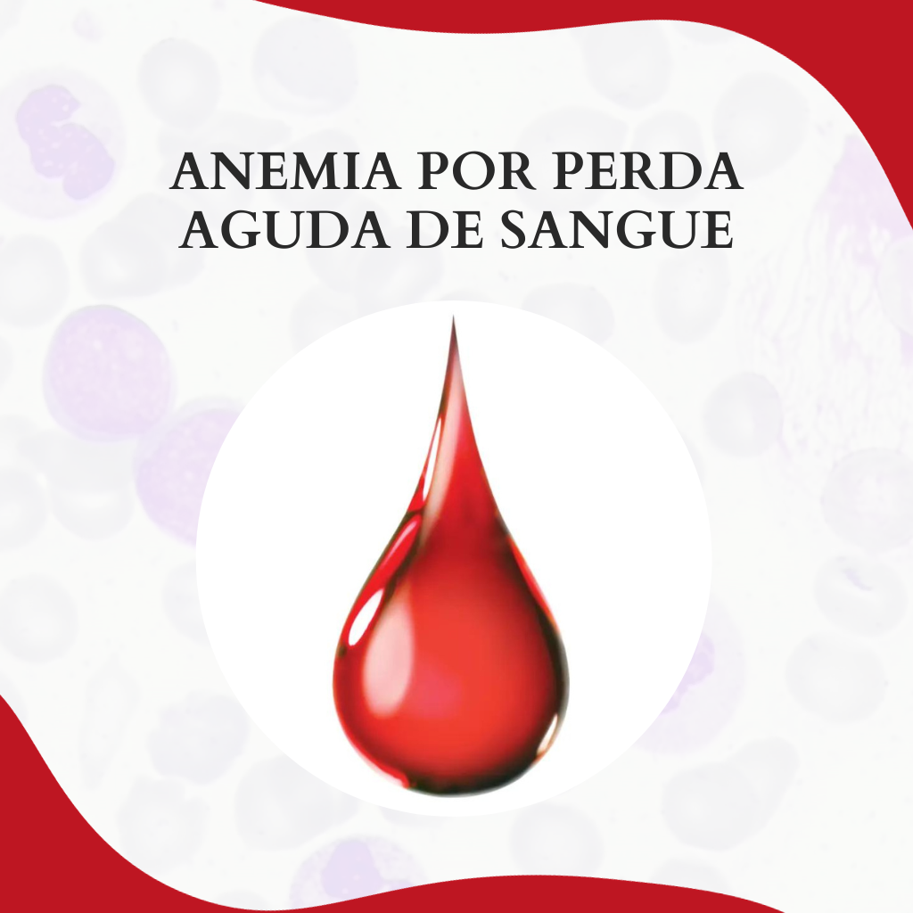 Anemia Por Perda Aguda De Sangue Atlas Em Hematologia