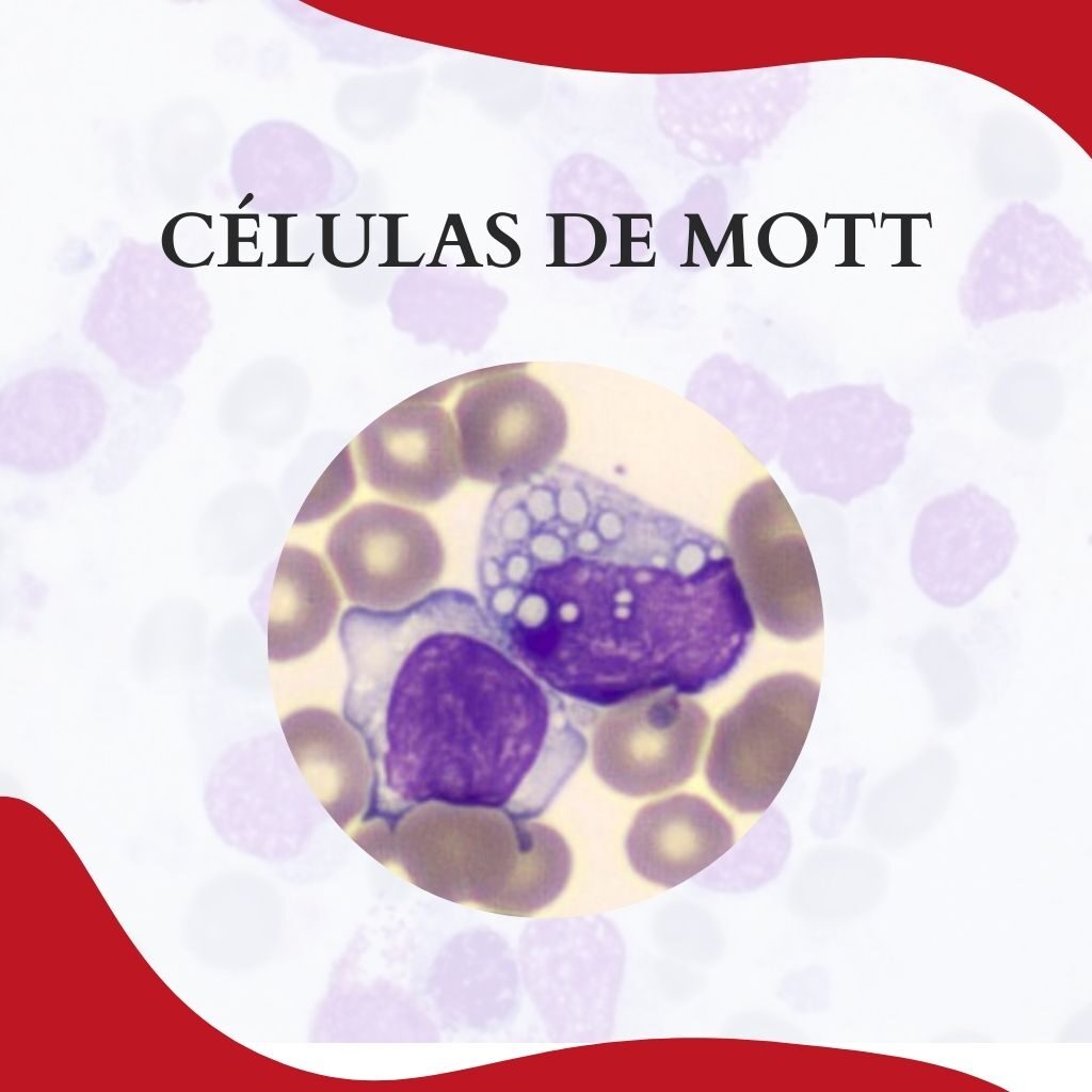 CÉLULAS DE MOTT