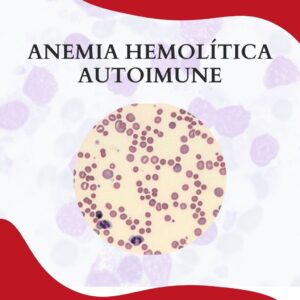 ANEMIA HEMOLÍTICA AUTOIMUNE POR ANTICORPOS FRIOS E QUENTES
