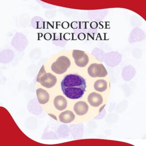 Linfocitose policlonal