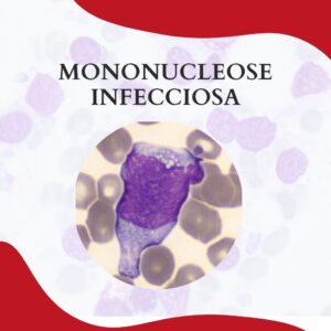 mononucleose infecciosa