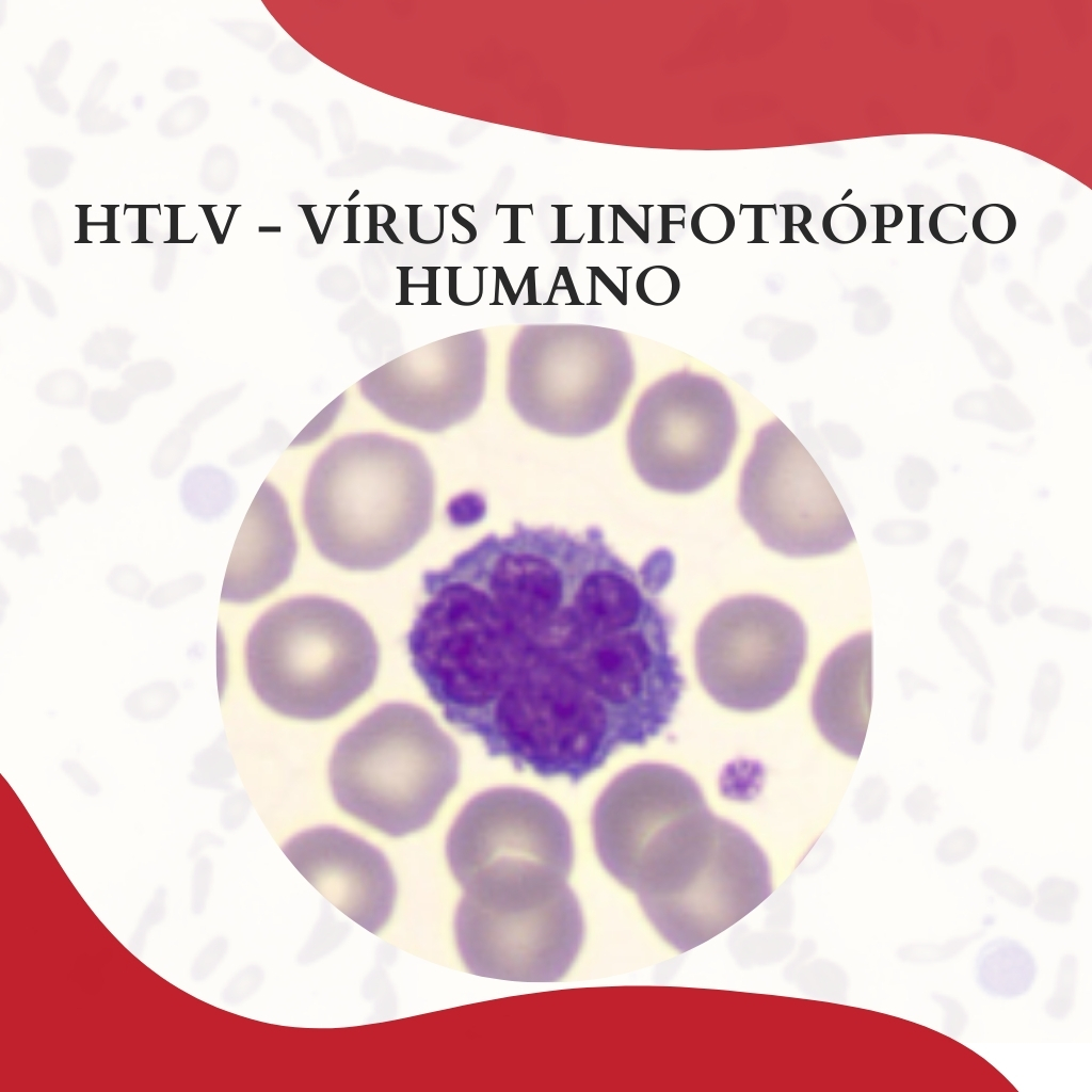 HTLV - VÍRUS T LINFOTRÓPICO HUMANO - Atlas Em Hematologia