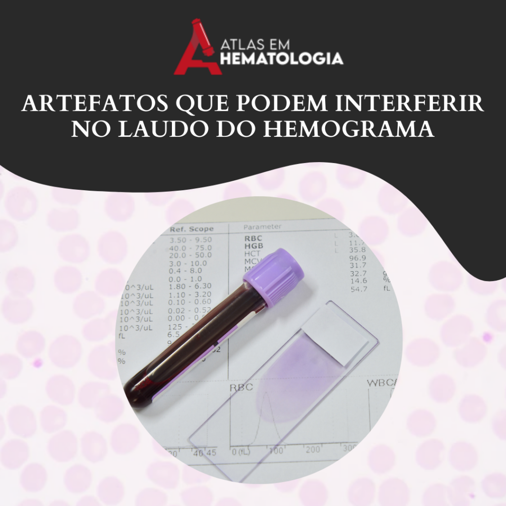 ARTEFATOS QUE PODEM INTERFERIR NO LAUDO DO HEMOGRAMA