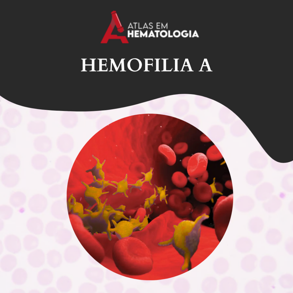HEMOFILIA A