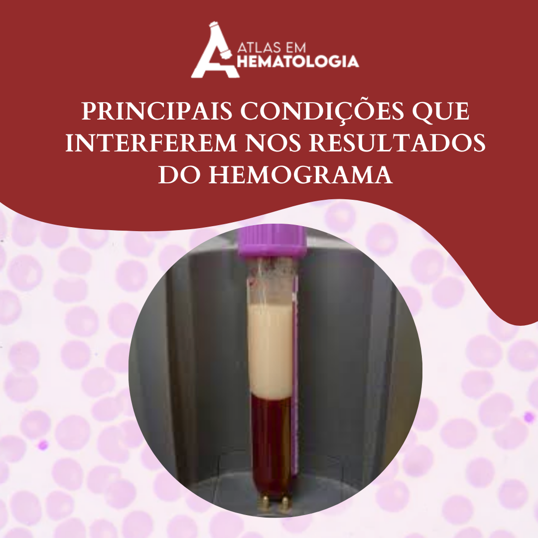 PRINCIPAIS CONDIÇÕES QUE INTERFEREM NOS RESULTADOS DO HEMOGRAMA