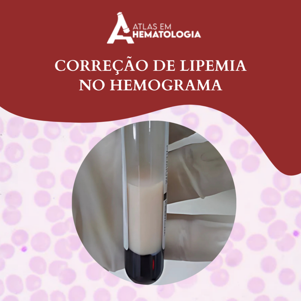 CORREÇÃO DE LIPEMIA NO HEMOGRAMA