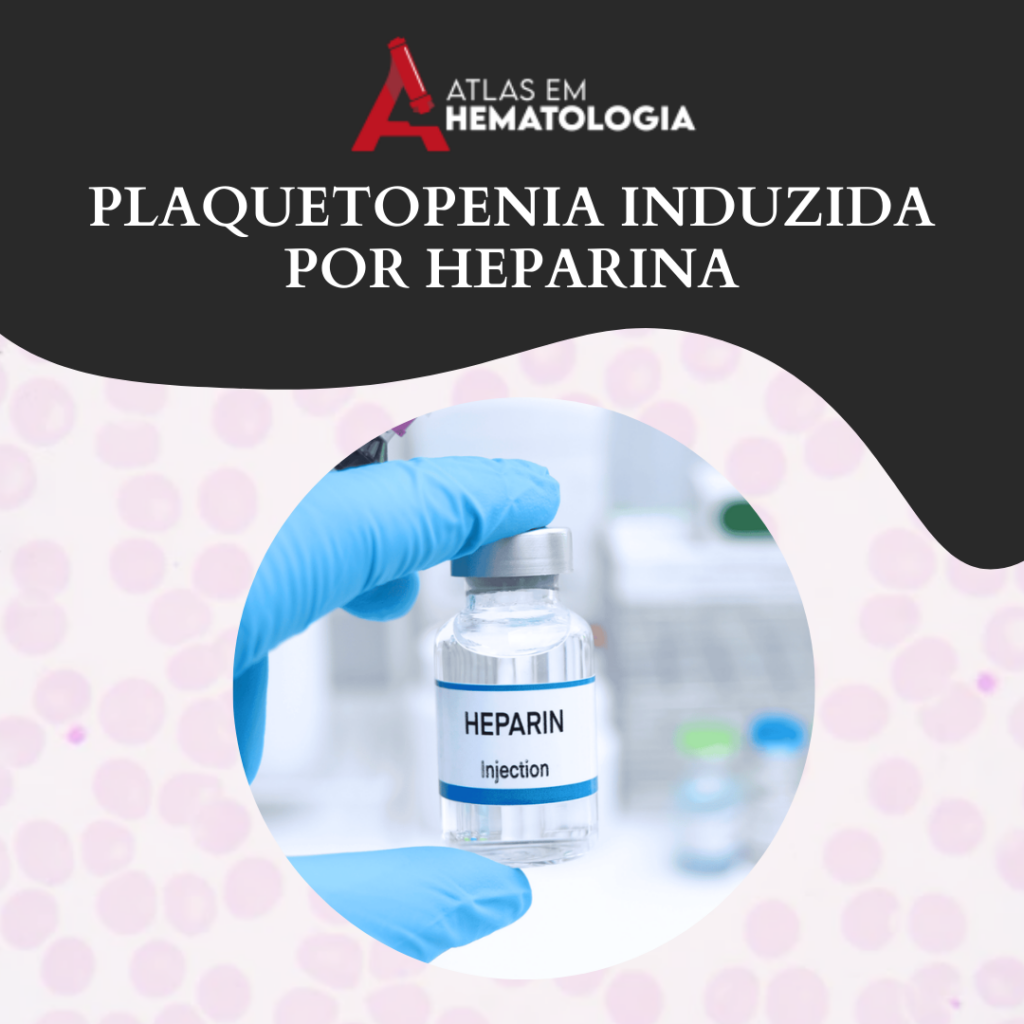 PLAQUETOPENIA INDUZIDA POR HEPARINA