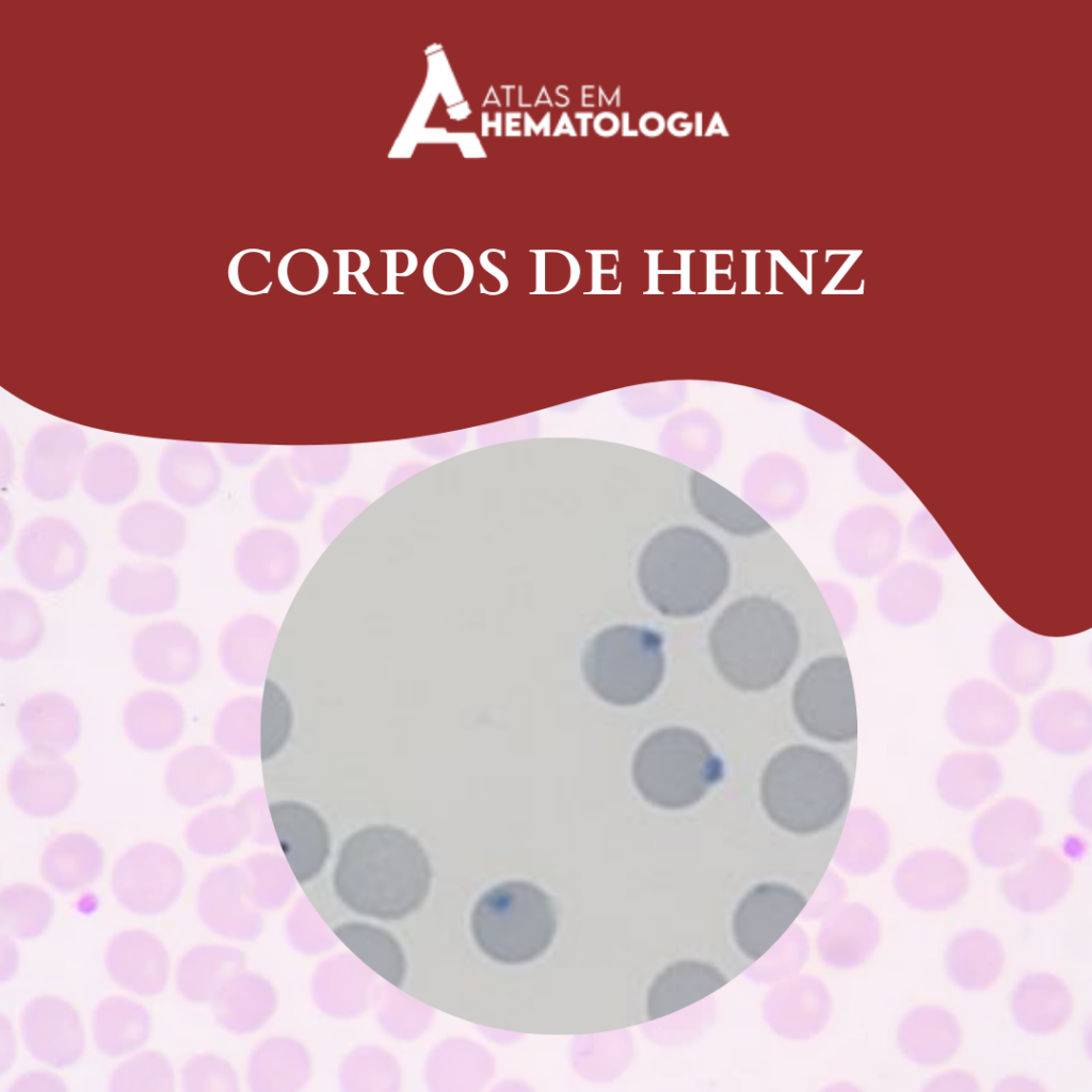CORPOS DE HEINZ