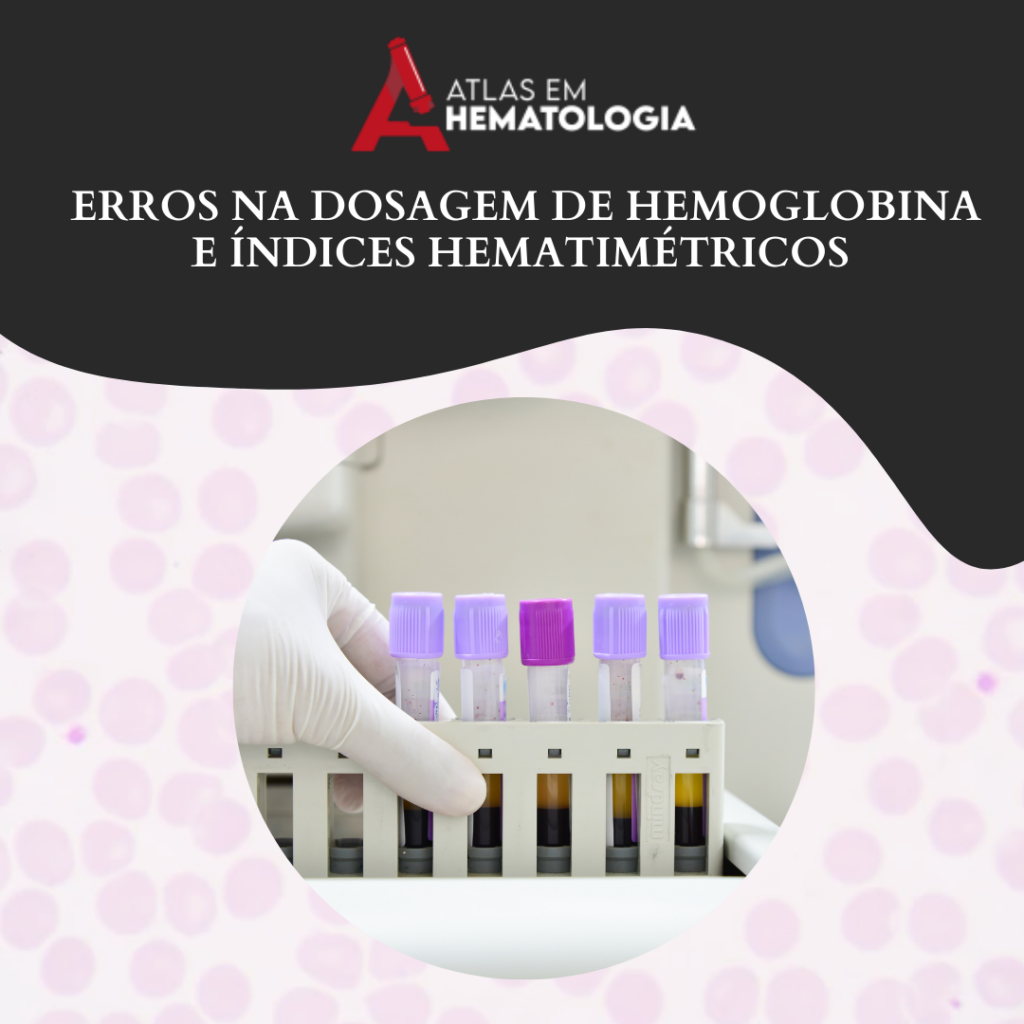 Fatores que causam erros na dosagem de hemoglobina e índices hematimétricos