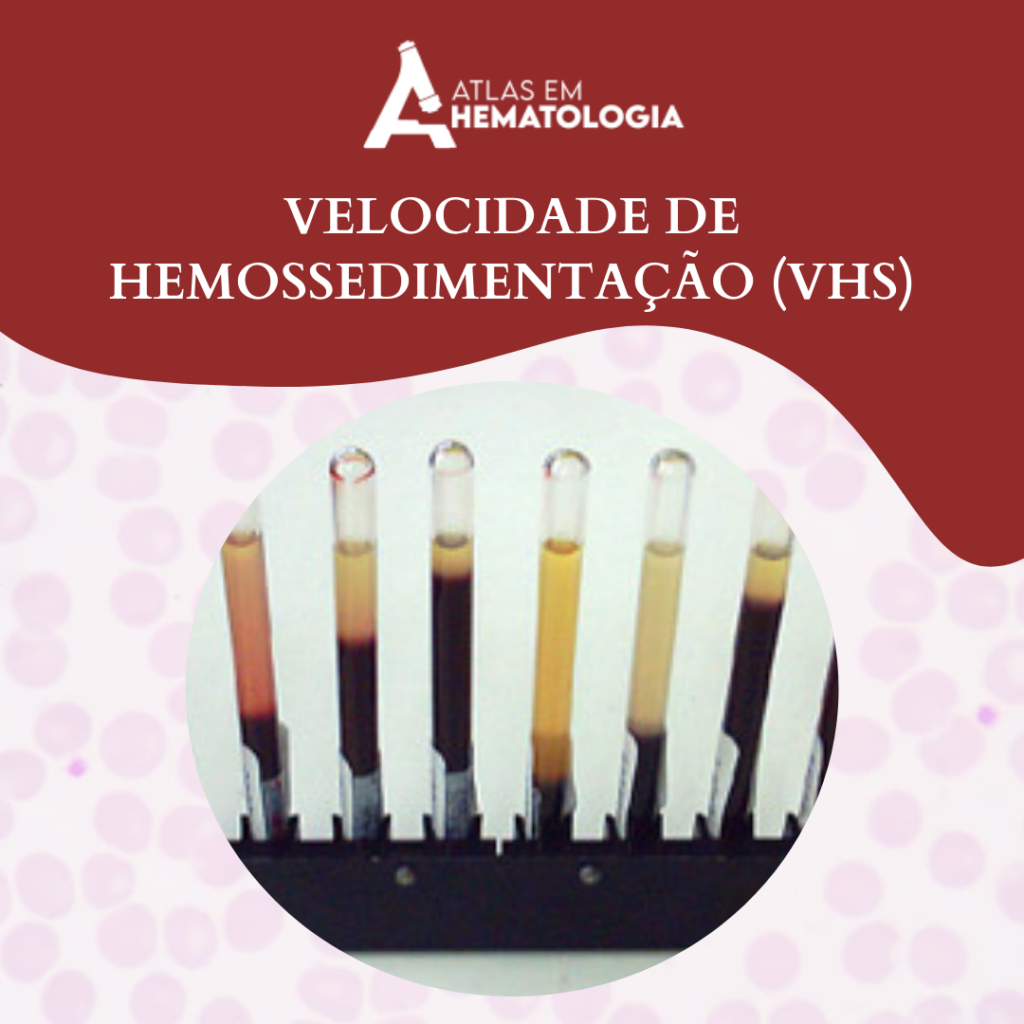 Velocidade de Hemossedimentação (VHS)