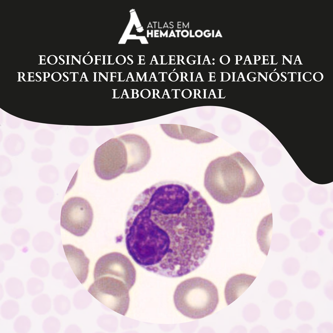 EOSINÓFILOS E ALERGIA: O PAPEL NA RESPOSTA INFLAMATÓRIA E DIAGNÓSTICO LABORATORIAL