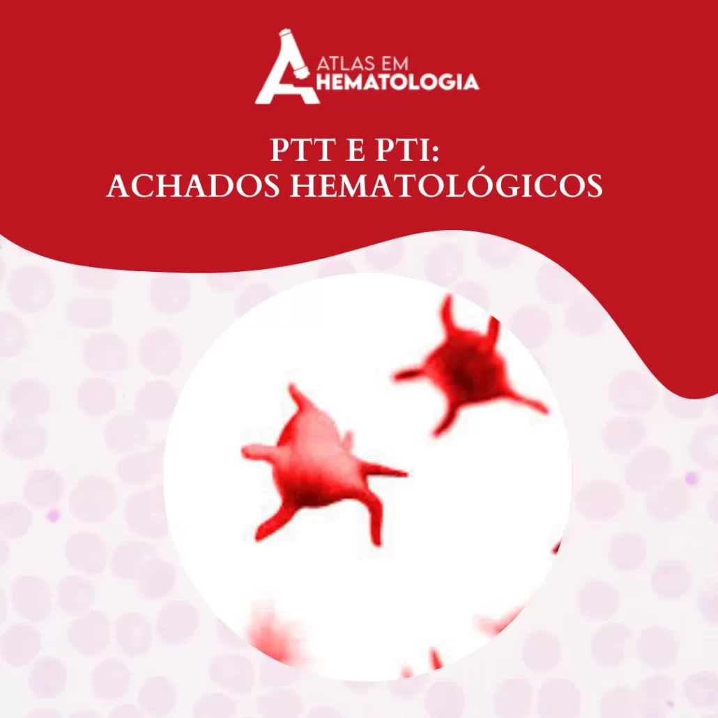 PTT E PTI: ACHADOS HEMATOLÓGICOS