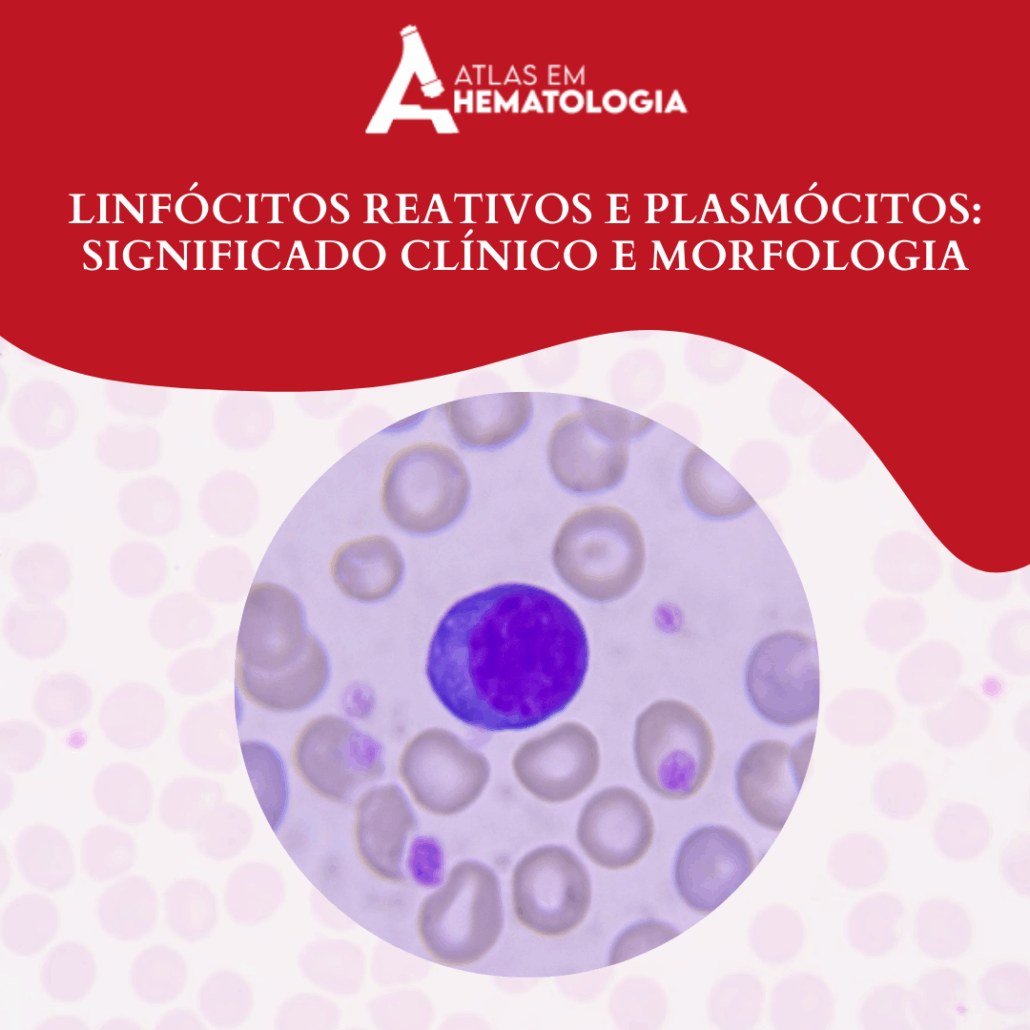Linfócitos Reativos e Plasmócitos: Significado Clínico e Morfologia