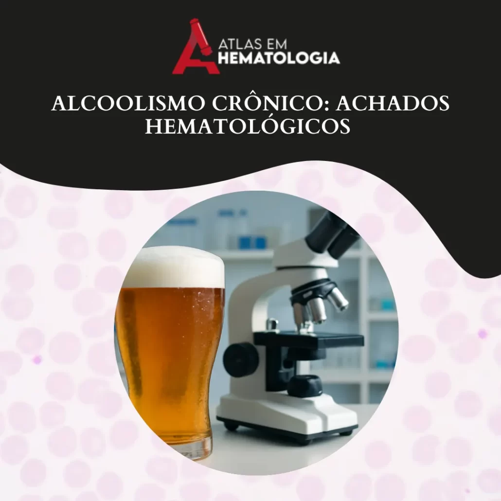 Alcoolismo Crônico: Achados Hematológicos
