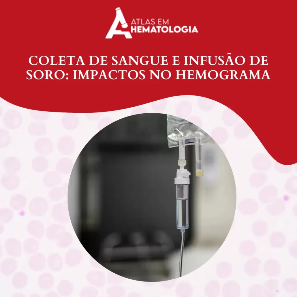 Coleta de Sangue e Infusão de Soro: Impactos no Hemograma