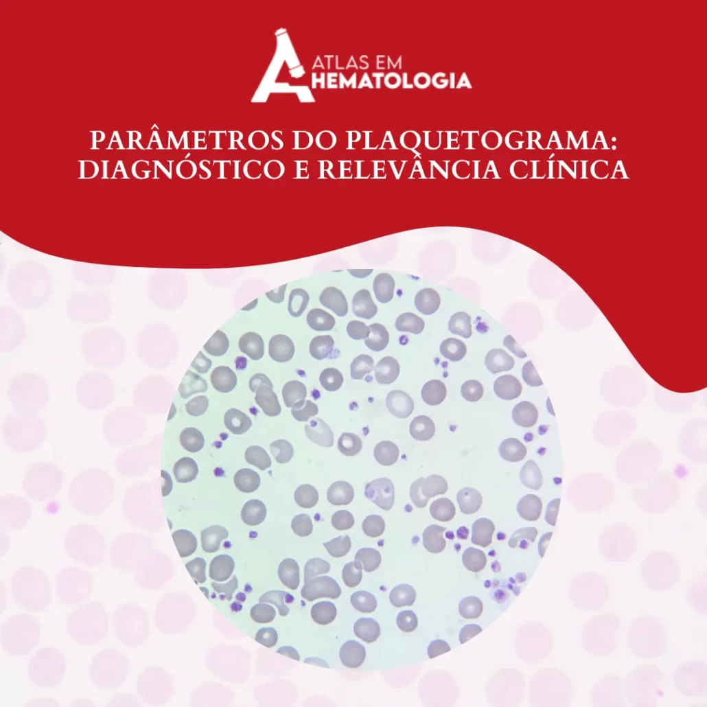 Parâmetros do Plaquetograma: Diagnóstico e Relevância Clínica