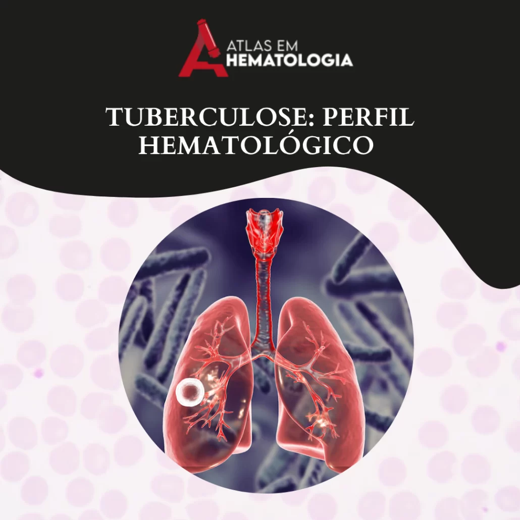 Tuberculose: Perfil Hematológico
