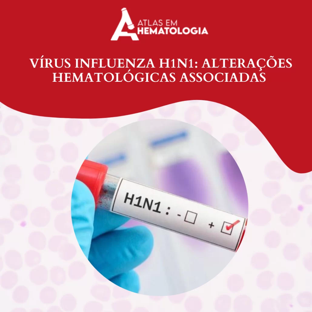 Vírus Influenza H1N1 : Alterações Hematológicas Associadas