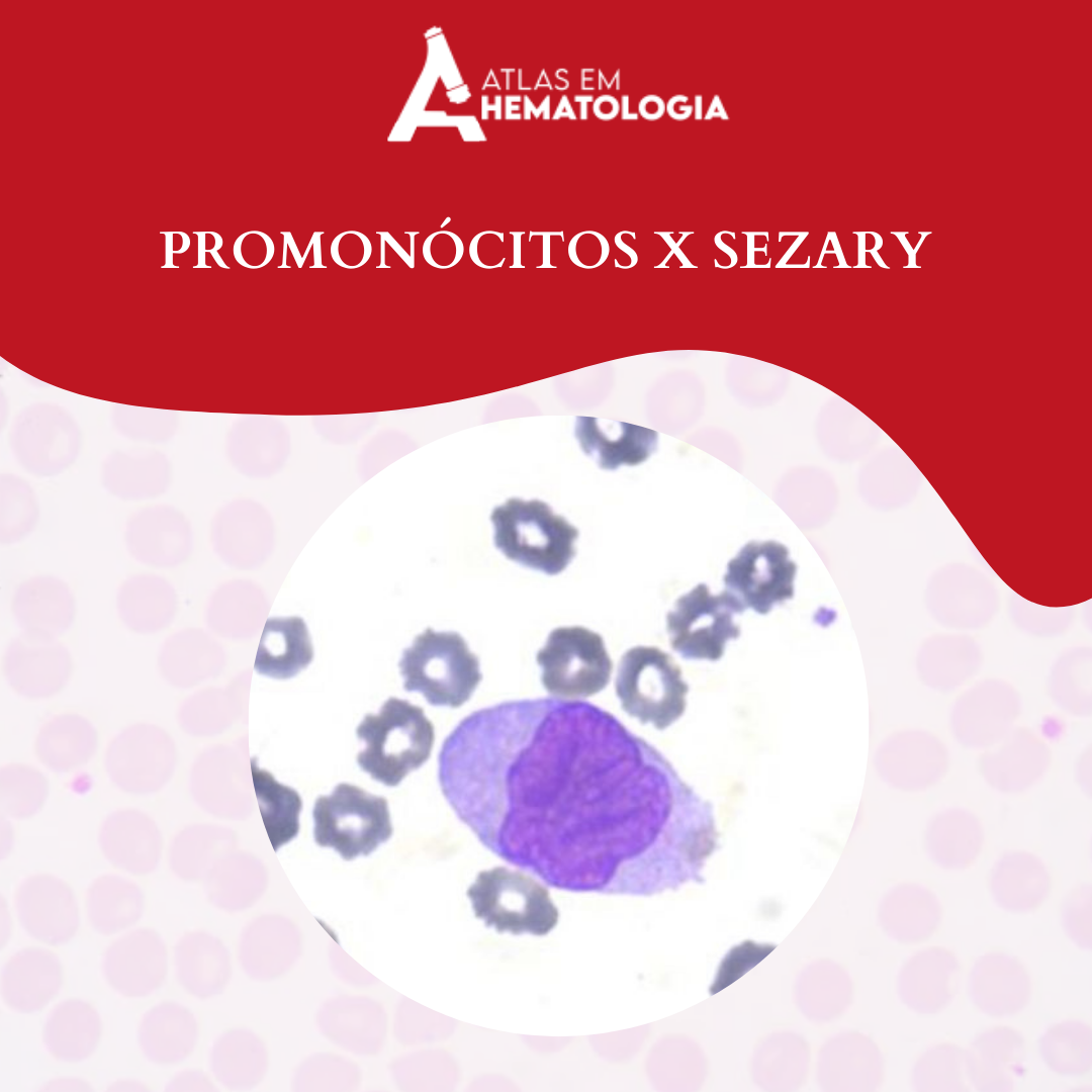 Inicio - Atlas Em Hematologia